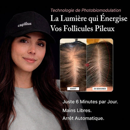 Capillus, relancez la pousse en quelques minutes par jour
