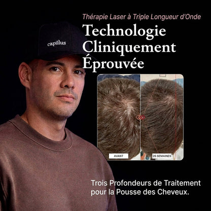 Capillus, relancez la pousse en quelques minutes par jour