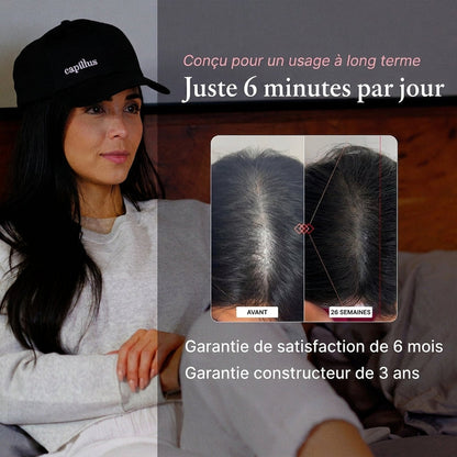 Capillus, relancez la pousse en quelques minutes par jour